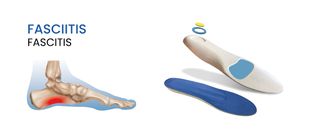 Flexor Soft Care Fasciitis Flexor Soft Care Fasciitis